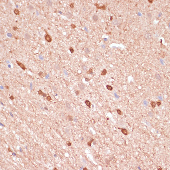 Immunohistochemistry of paraffin-embedded Rat brain using ACAT2 Polyclonal Antibody at dilution of  1:100 (40x lens).