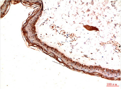 Immunohistochemistry of paraffin-embedded Human skin tissue using PDGFRA Monoclonal Antibody at dilution of 1:200.