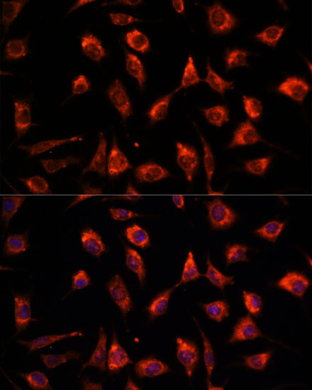 Immunofluorescence analysis of L929 cells using TPT1 Polyclonal Antibody at dilution of 1:100. Blue: DAPI for nuclear staining.