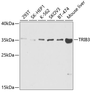 Western blot analysis of extracts of various cell lines using TRIB3 Polyclonal Antibody at dilution of 1:1000.