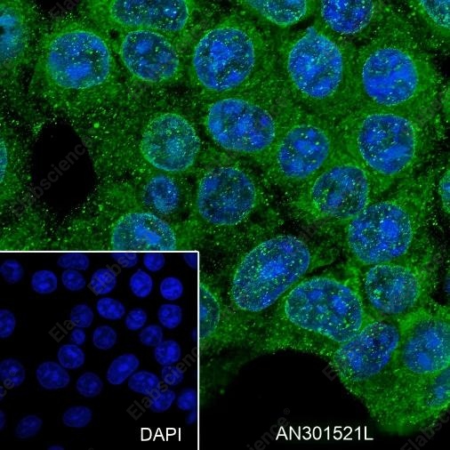 Recombinant FBXW7 Monoclonal Antibody - 4