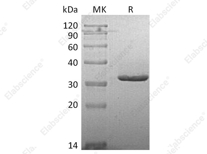 Recombinant Human IgG2-Fc Protein - 1