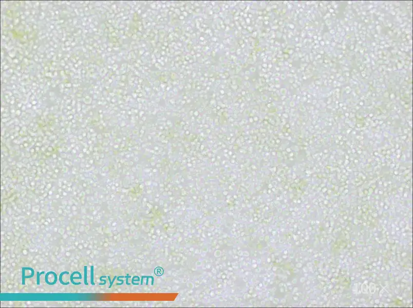 OKT 11 Cell Complete Medium - 2