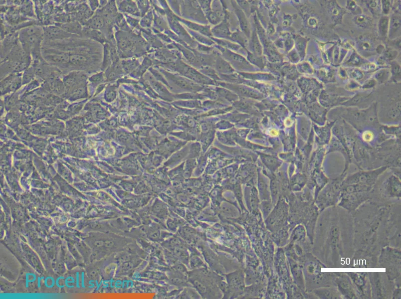 Mouse Ovarian Fibroblast Complete Medium - small - 6