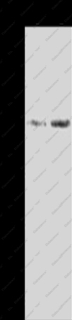 AKR1B1 Polyclonal Antibody - 1