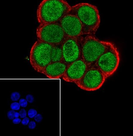 Recombinant FOXA1 Monoclonal Antibody - small - 4