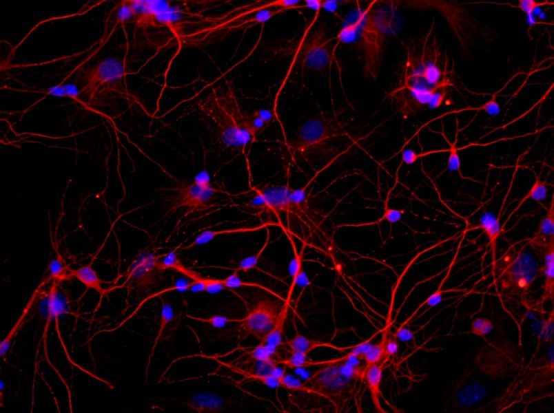 Rat Hippocampal Neuron Complete MediumRat Hippocampal Neuron Complete Medium - 2