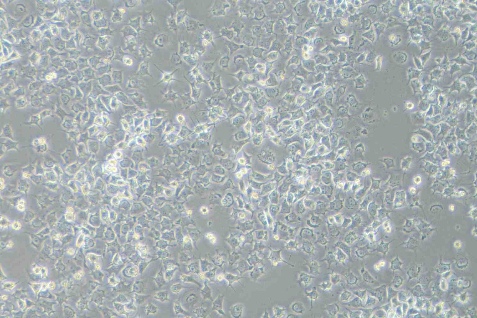 92-1 [Human uveal melanoma] Cell Complete Medium - 2