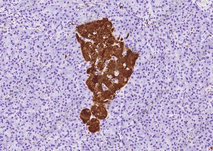 ENO2 Monoclonal Antibody - 1