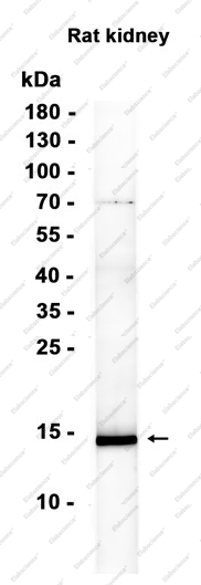 Recombinant Cystatin A Monoclonal Antibody - 1