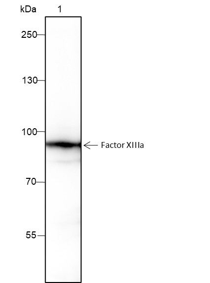 Recombinant Factor XIIIa Monoclonal Antibody-searchlist-1
