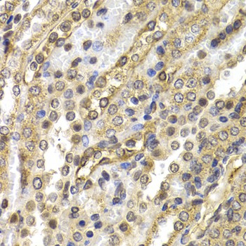 Immunohistochemistry of paraffin-embedded Rat kidney using NEDD9 Polyclonal Antibody at dilution of  1:200 (40x lens).