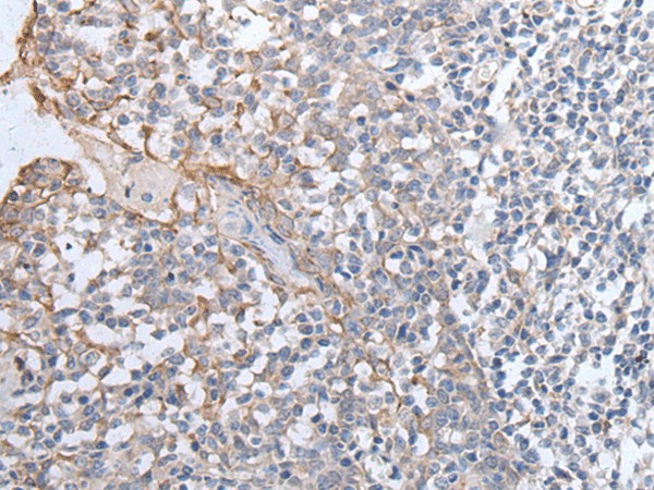 Immunohistochemistry of paraffin-embedded Human tonsil tissue  using GPD2 Polyclonal Antibody at dilution of 1:40(?200)