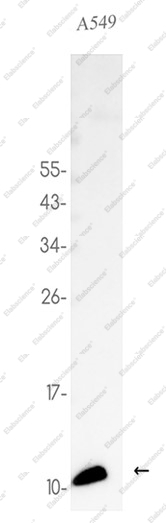Recombinant S100A4 Monoclonal Antibody - 1