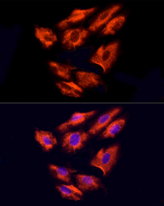 Immunofluorescence analysis of H9C2 cells using NPHP4 Polyclonal Antibody at dilution of 100 (40x lens). Blue: DAPI for nuclear staining.