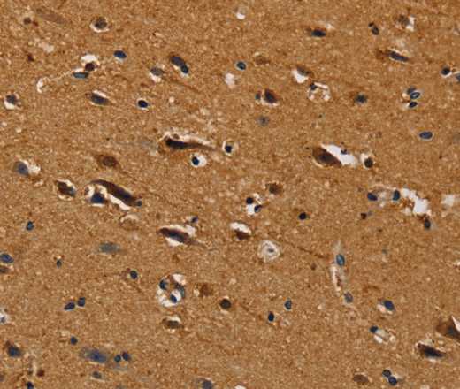 Immunohistochemistry of paraffin-embedded Human brain  tissue using CENPU Polyclonal Antibody at dilution 1:30