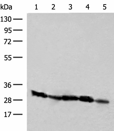 Western blot analysis of Raji Jurkat K562 and 231 cell Human kidney tissue lysates  using CD48 Polyclonal Antibody at dilution of 1:250