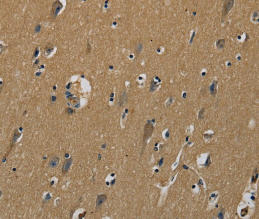 Immunohistochemistry of paraffin-embedded Human brain  tissue using PLIN3 Polyclonal Antibody at dilution 1:50