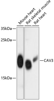 Western blot analysis of extracts of various cell lines using CAV3 Polyclonal Antibody at dilution of 1:3000.