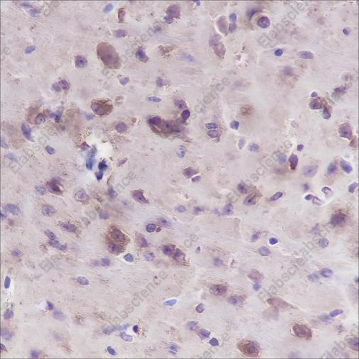 Recombinant Muscarinic Acetylcholine Receptor 2/CM2 Monoclonal Antibody - 3