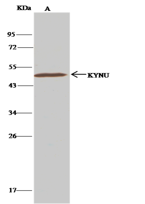Recombinant KYNU Monoclonal Antibody