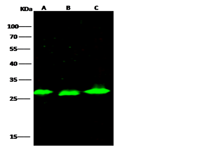 Recombinant PSPH Monoclonal Antibody