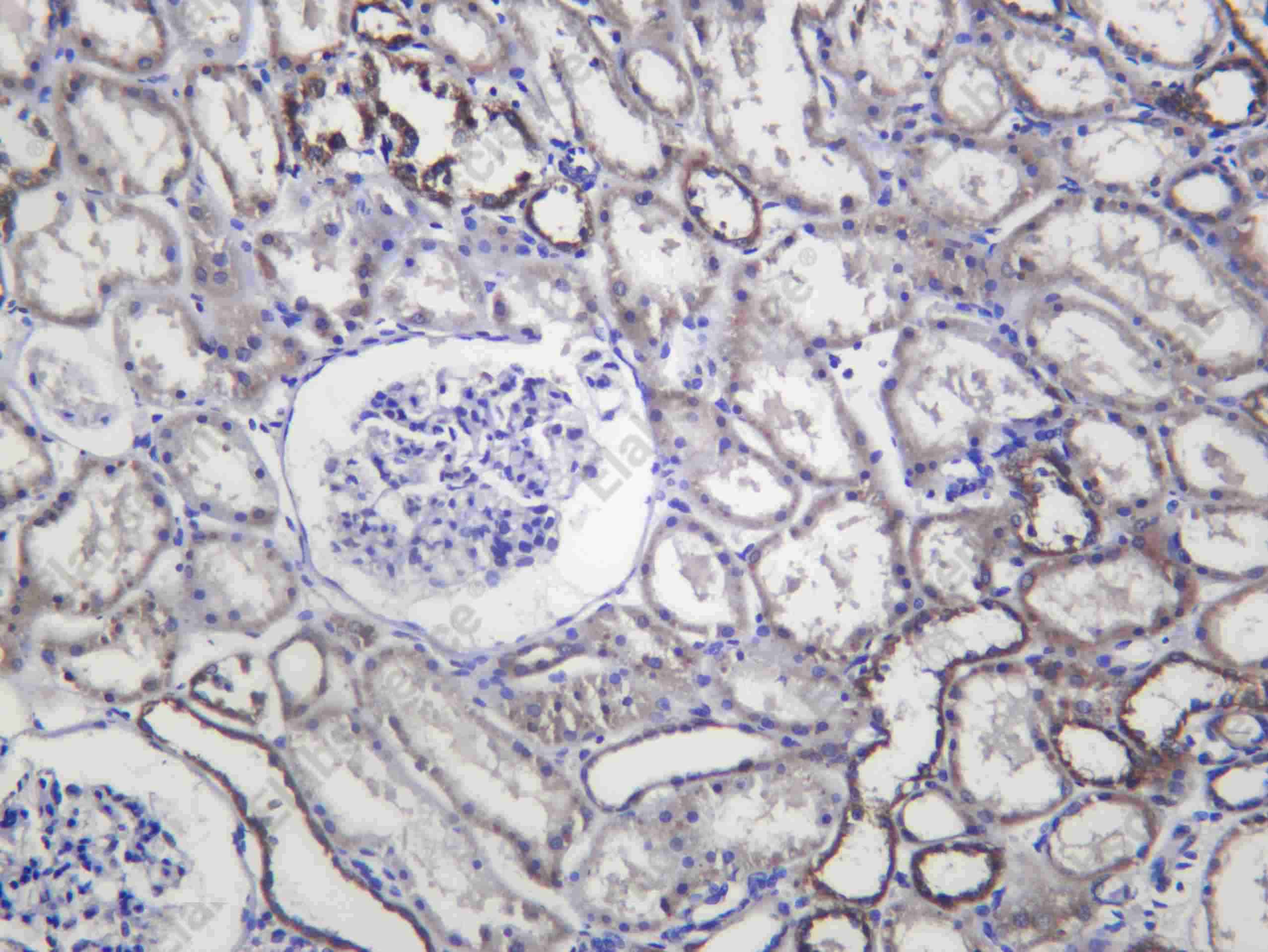 Recombinant TIP49A Monoclonal Antibody - 1