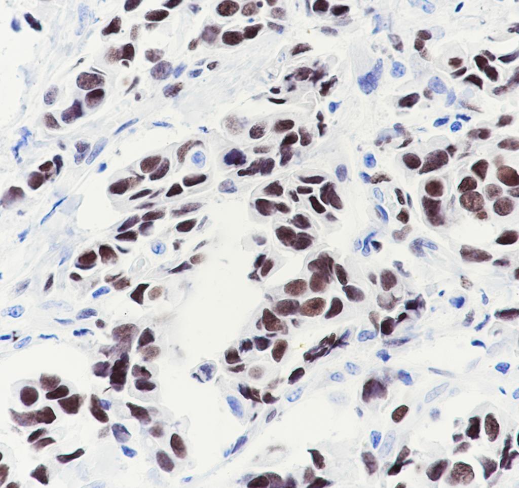 Recombinant COUP-TFII Monoclonal Antibody - 3