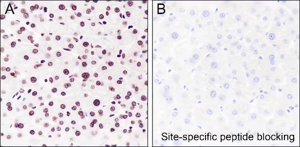 Recombinant Histone H4 (Acetyl Lys77) Monoclonal Antibody - small - 5