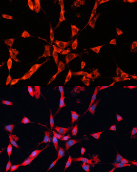 Immunofluorescence analysis of NIH/3T3 cells using GARS Polyclonal Antibody at dilution of  1:100. Blue: DAPI for nuclear staining.