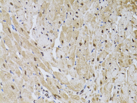 Immunohistochemistry of paraffin-embedded Rat heart using HUS1 Polyclonal Antibody at dilution of  1:100 (40x lens).