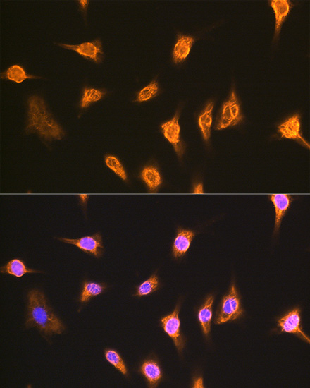 Immunofluorescence analysis of L929 cells using ALIX / PDCD6IP Polyclonal Antibody at dilution of 1:100. Blue: DAPI for nuclear staining.