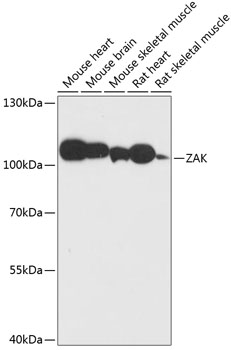 Western blot analysis of extracts of various cell lines using ZAK Polyclonal Antibody at dilution of 1:3000.