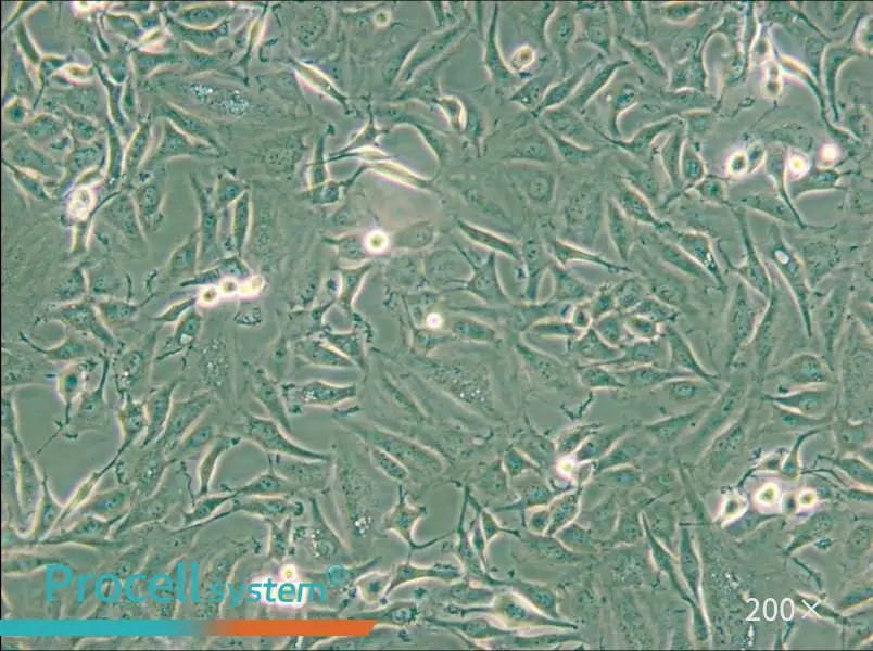 KTC-1 Cell Complete Medium - small - 5