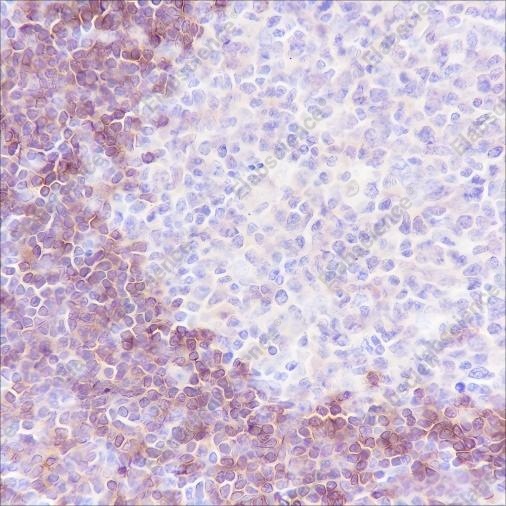 Recombinant Human IgD Monoclonal Antibody - 2