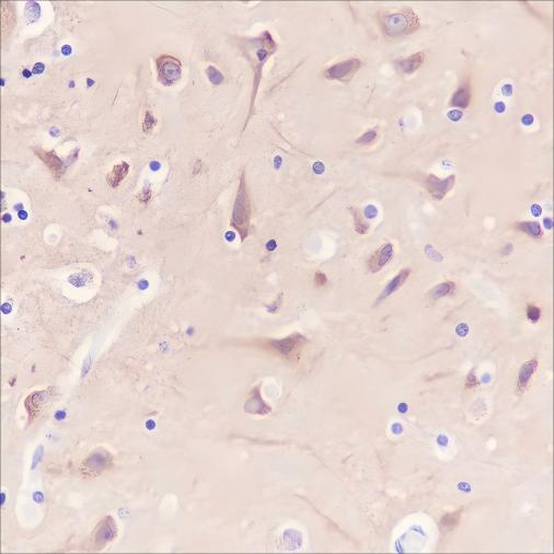 Recombinant Dynamin 1 Monoclonal Antibody - small - 2