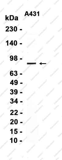 Recombinant GRK2 Monoclonal Antibody - 2