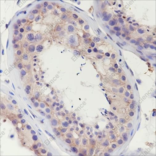 Recombinant ClC-2 Monoclonal Antibody - 2