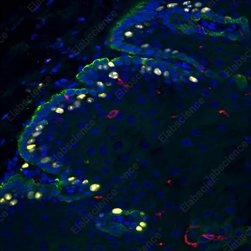 Recombinant CD1a Monoclonal Antibody - 5