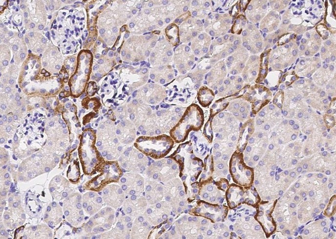 Recombinant TROP-2/TACSTD2 Monoclonal Antibody - small - 2