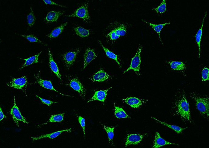 Recombinant PDHA1 Monoclonal Antibody-searchlist-1