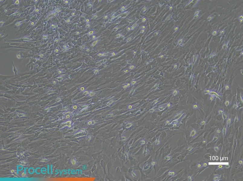 Rat Pancreatic Stellate Cell Complete Medium - 2