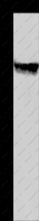 CYP2E1 Polyclonal Antibody - 1