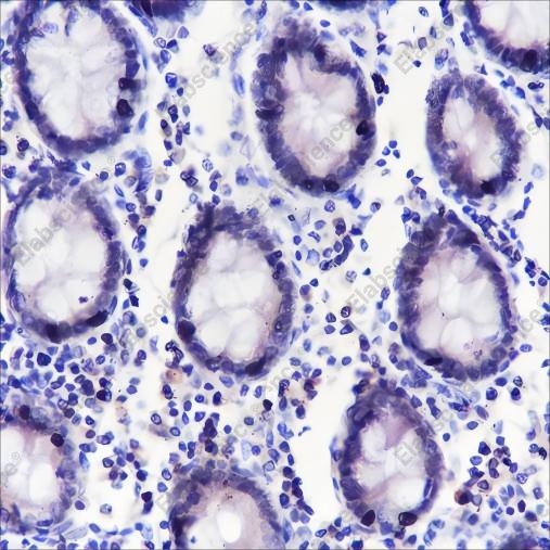 Recombinant ING5 Monoclonal Antibody - 2