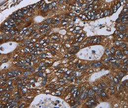 GOLGA2 Polyclonal Antibody - 2