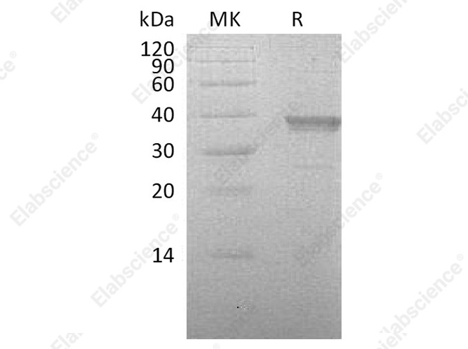Recombinant Human HABP2 Protein (His Tag) - 1