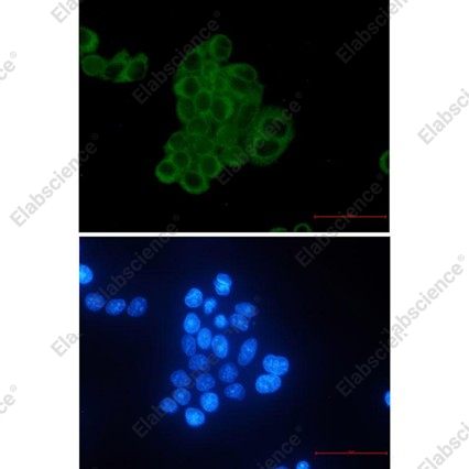 Recombinant MEK2 Monoclonal Antibody - 3