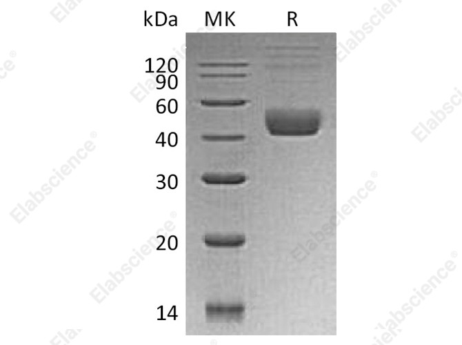 Recombinant Human CTLA4 Protein (GST Tag) - 1