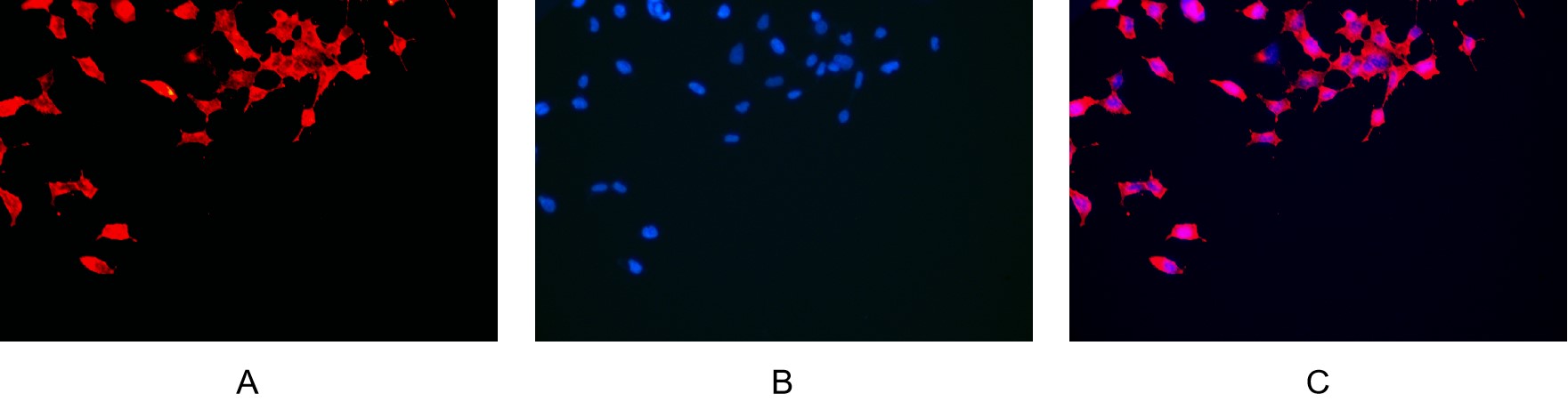 Recombinant α smooth muscle actin Monoclonal Antibody - small - 7