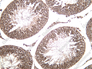 Recombinant ID4 Monoclonal Antibody - 1